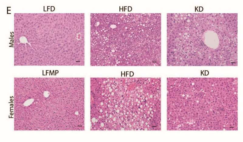 Nghiên cứu chỉ ra tác động tiêu cực của chế độ ăn ketogenic đến sức khỏe chuyển hóa